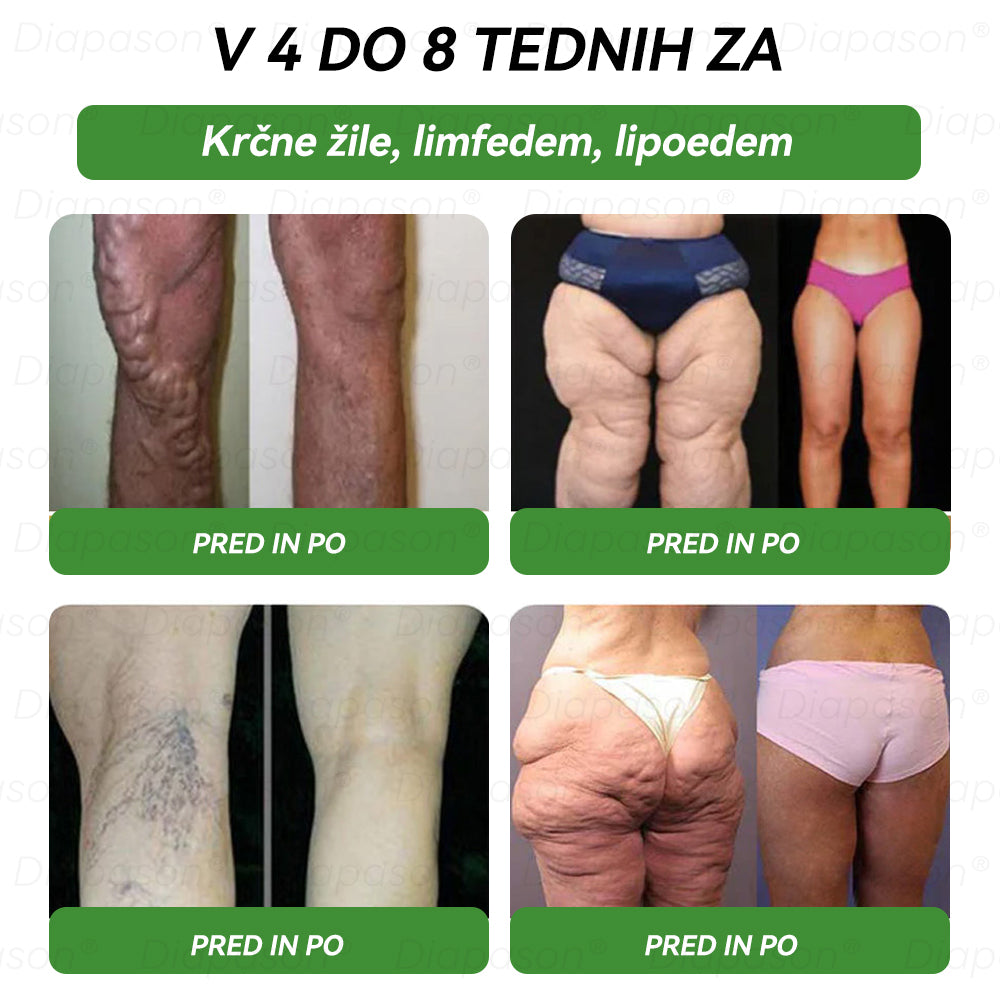 𝑈𝑟𝑎𝑑𝑛𝑎 𝑡𝑟𝑔𝑜𝑣𝑖𝑛𝑎 | 𝐃𝓲ａ𝓹𝓪𝓼𝐨𝓷 ® 👨‍⚕️👨‍⚕️Ｇ𝖫𝑃-𝟏 𝑆𝑒𝑑𝑒𝑚 𝑣 𝑒𝑛𝑒𝑚 𝑍𝑑𝑟𝑎𝑣𝑠𝑡𝑣𝑒𝑛𝑎 𝑅𝑒š𝑖𝑡𝑒𝑣 𝑃𝑒𝑟𝑜𝑟𝑎𝑙𝑛𝑎 𝑇𝑒𝑘𝑜č𝑖𝑛𝑎 - Debelost, bolezni srca in ožilja, diabetes, spalna apneja, težave s sklepi in še več