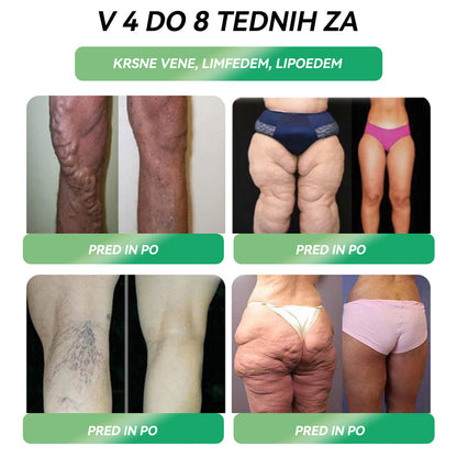 🌼Več kot 100.000 priporočil | Uradna trgovina | 𝑆𝑇𝐷𝐸™💎💎 𝐺𝐿𝑃-1 𝐼𝑧𝑔𝑢𝑏𝑎 𝑇𝑒ž𝑒 𝑈𝑠𝑡𝑛𝑎 𝑅𝑒š𝑖𝑡𝑒𝑣 - Debelost, bolezni srca in ožilja, diabetes, spalna apneja, težave s sklepi in še več